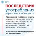 Минздрав Кузбасса подготовил материалы о признаках употребления наркотиков